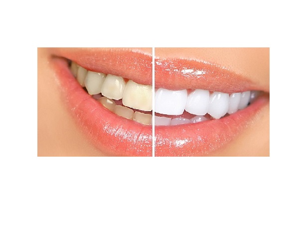 best dentist in raipur