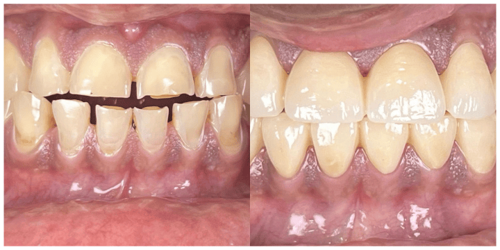 best dental clinic in raipur