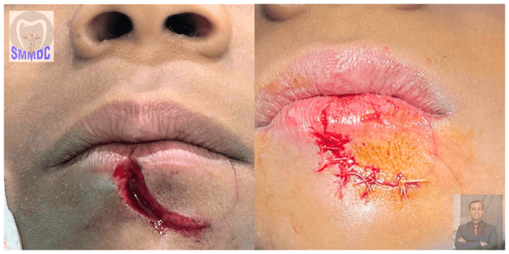 Best dental clinic in Raipur